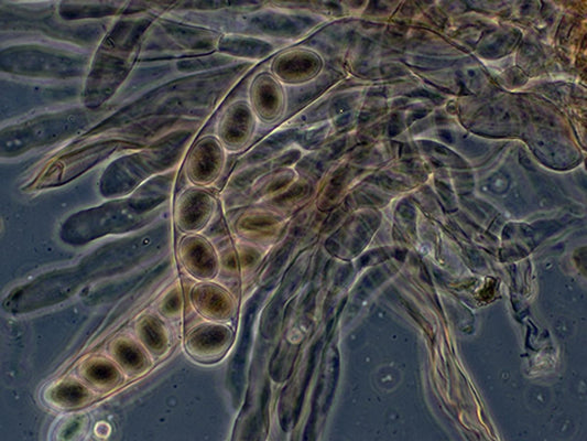 Understanding and Treating Your Dog's Paw Yeast Infection